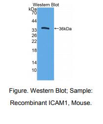 https://msimg.bioon.com/bionline/goods-no-pic.png