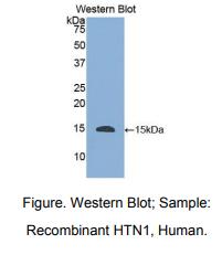 人唾液富组蛋白1(HTN1)多克隆抗体