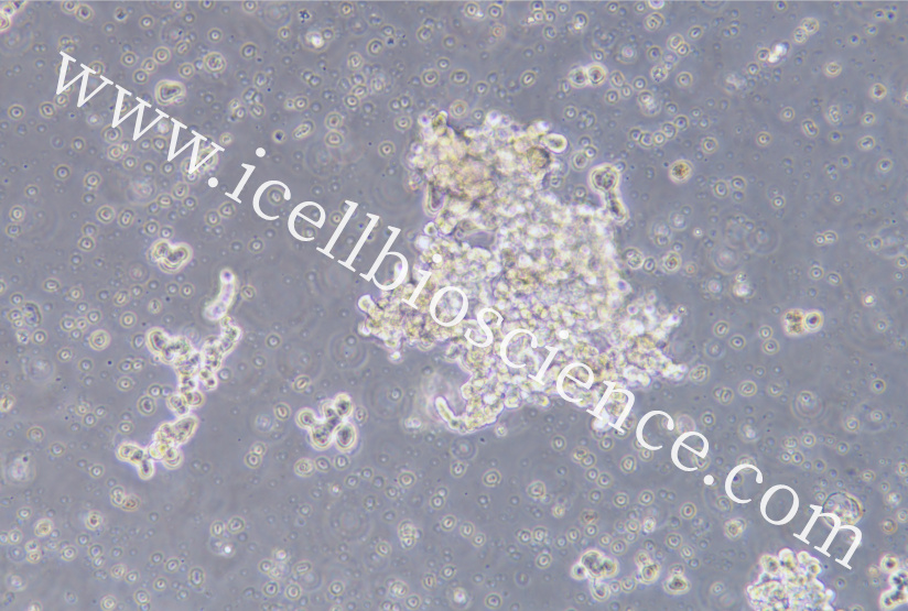 DU4475细胞/DU-4475细胞/DU-4475/DU4475/人乳腺上皮细胞