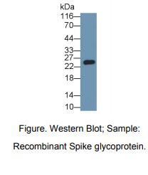 https://msimg.bioon.com/bionline/goods-no-pic.png