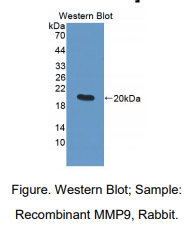 https://msimg.bioon.com/bionline/goods-no-pic.png