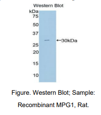 https://msimg.bioon.com/bionline/goods-no-pic.png