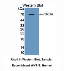 https://msimg.bioon.com/bionline/goods-no-pic.png