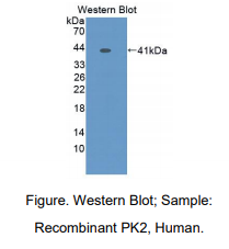 https://msimg.bioon.com/bionline/goods-no-pic.png