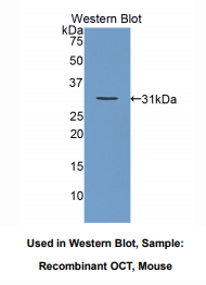 https://msimg.bioon.com/bionline/goods-no-pic.png