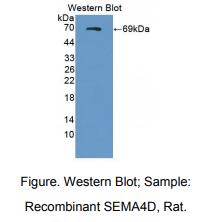 大鼠信号素4D(SEMA4D)多克隆抗体