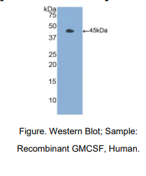 https://msimg.bioon.com/bionline/goods-no-pic.png