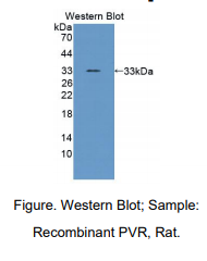 https://msimg.bioon.com/bionline/goods-no-pic.png