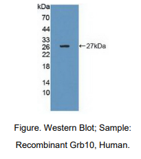 https://msimg.bioon.com/bionline/goods-no-pic.png