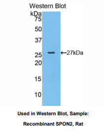 https://msimg.bioon.com/bionline/goods-no-pic.png