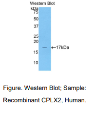 人复合素2(CPLX2)多克隆抗体