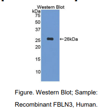 https://msimg.bioon.com/bionline/goods-no-pic.png