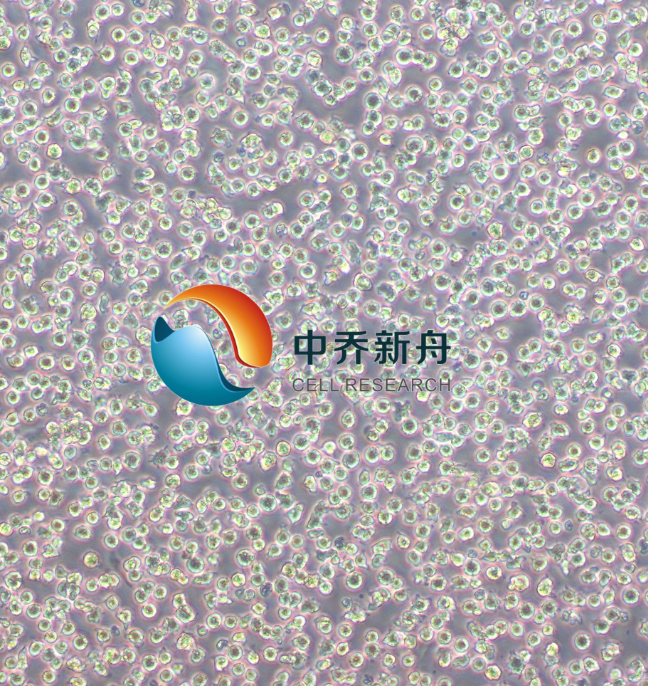 人非霍奇金淋巴瘤细胞