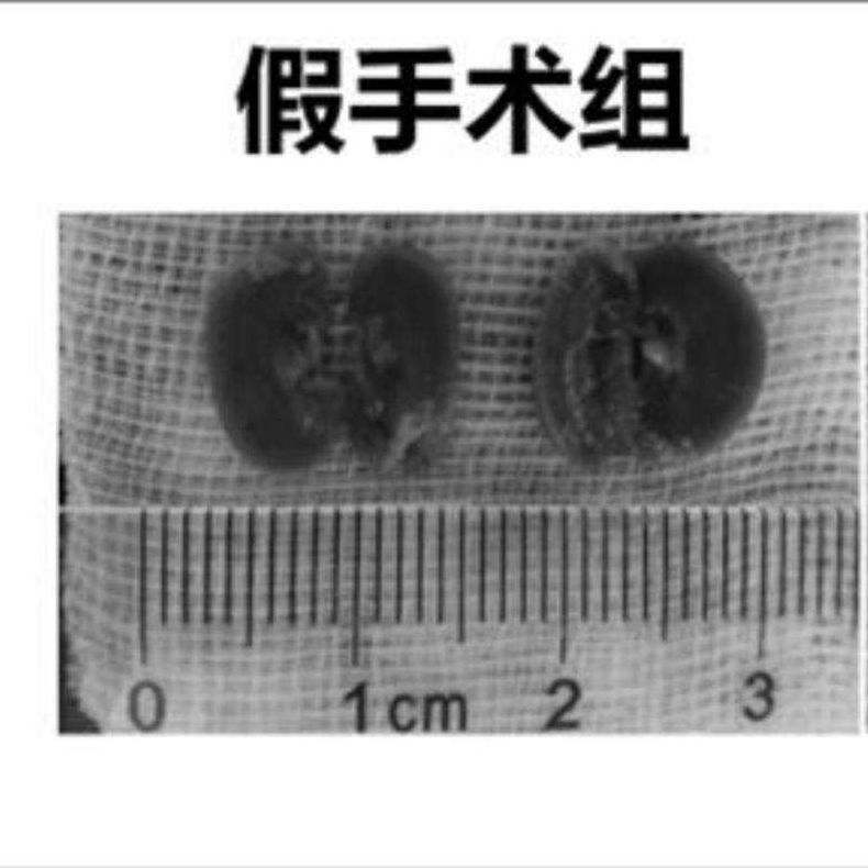 急性肾衰竭动物模型  泌尿系统模型