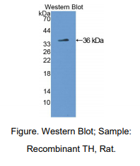 https://msimg.bioon.com/bionline/goods-no-pic.png