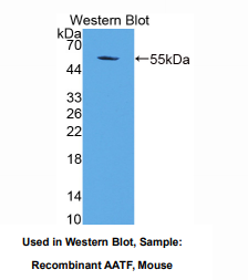 https://msimg.bioon.com/bionline/goods-no-pic.png