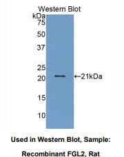 https://msimg.bioon.com/bionline/goods-no-pic.png