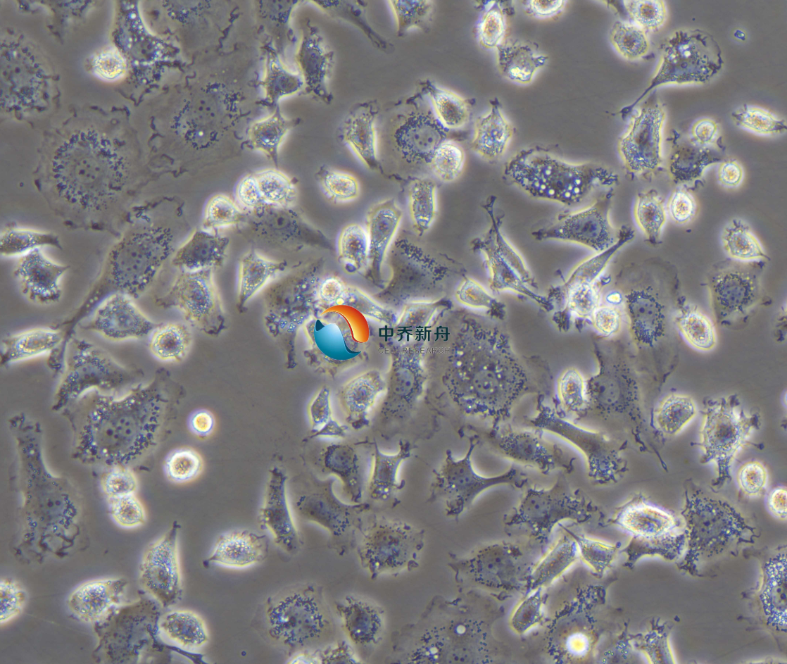 https://img.medsci.cn/8eee53bbc4cb7a98de615e72115896bc4e27fda5cbb764dbd67d9d641c2bb46a.png