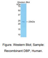 人维生素D结合蛋白(DBP)多克隆抗体
