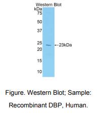 https://msimg.bioon.com/bionline/goods-no-pic.png