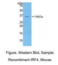 小鼠干扰素调节因子4(IRF4)多克隆抗体
