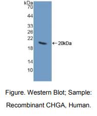 人嗜铬蛋白A(CHGA)多克隆抗体