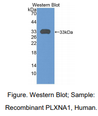 https://msimg.bioon.com/bionline/goods-no-pic.png