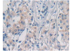 人核膜含血影蛋白重复蛋白1(Nesp1)多克隆抗体