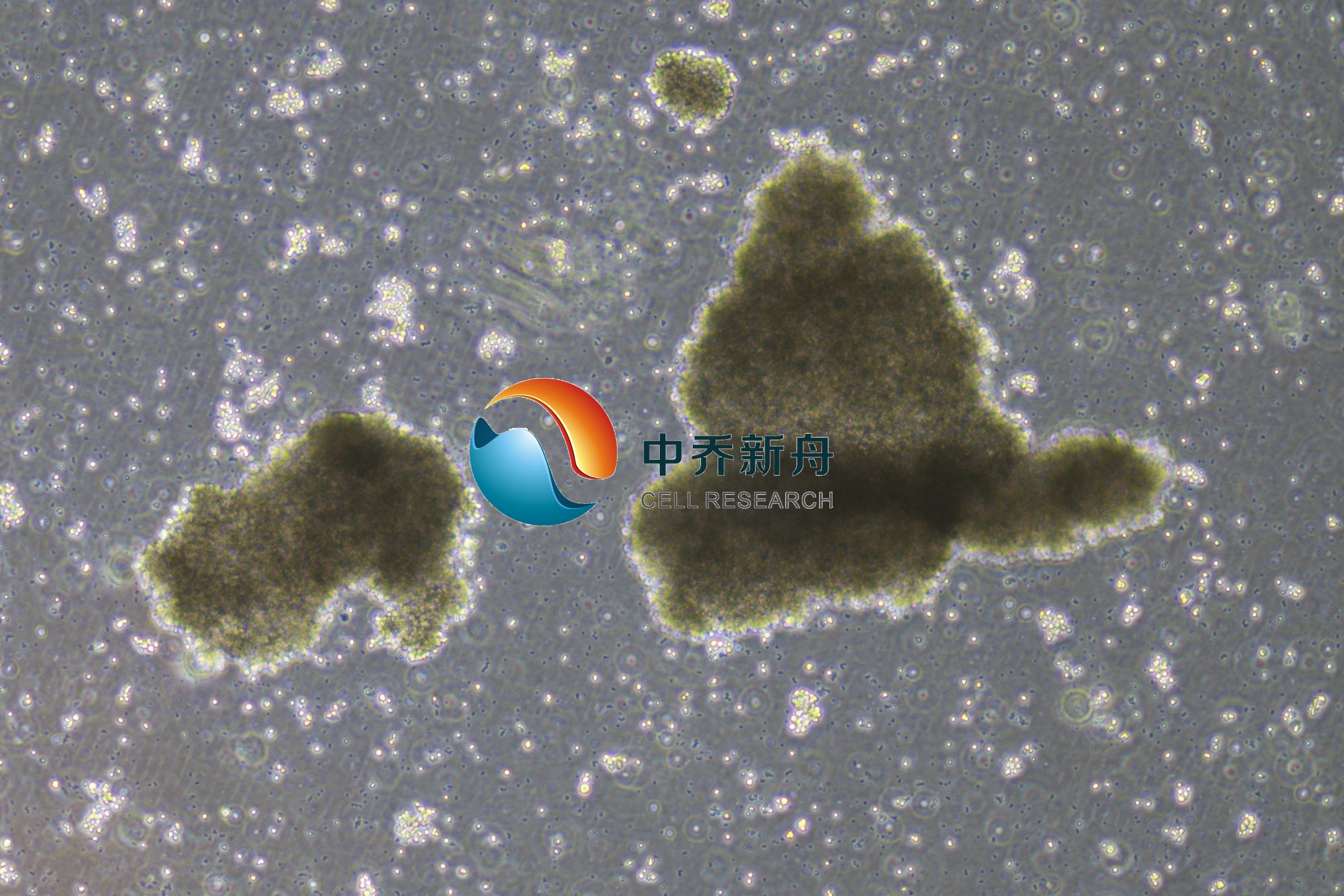 OCI-Ly3 人弥漫大 B 细胞淋巴瘤细胞