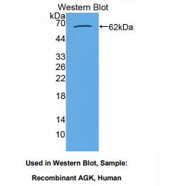 https://msimg.bioon.com/bionline/goods-no-pic.png