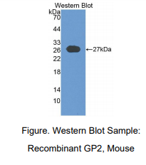 https://msimg.bioon.com/bionline/goods-no-pic.png