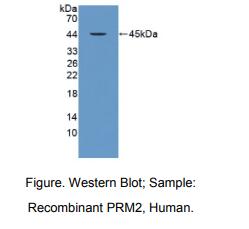 人鱼精蛋白2(PRM2)多克隆抗体