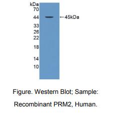 https://msimg.bioon.com/bionline/goods-no-pic.png