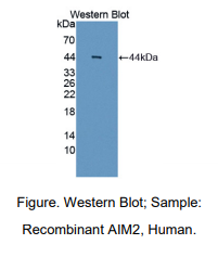 人黑素瘤缺乏因子2(AIM2)多克隆抗体