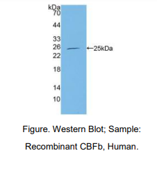 人核心结合因子β亚基(CBFb)多克隆抗体