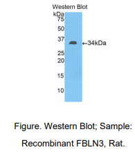 https://msimg.bioon.com/bionline/goods-no-pic.png