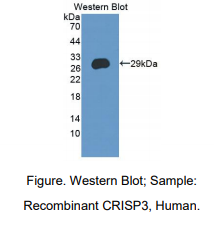 人半胱氨酸丰富分泌蛋白3(CRISP3)多克隆抗体