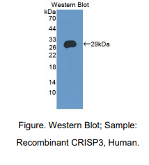 https://msimg.bioon.com/bionline/goods-no-pic.png