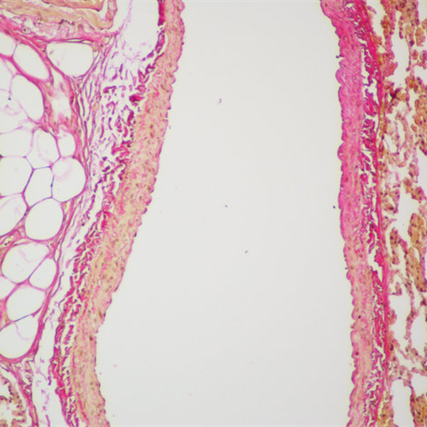 https://msimg.bioon.com/bionline/goods-no-pic.png