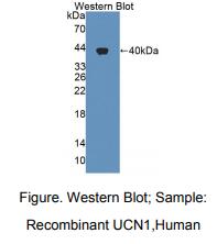 人尿皮质素(UCN)多克隆抗体