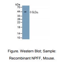 https://msimg.bioon.com/bionline/goods-no-pic.png