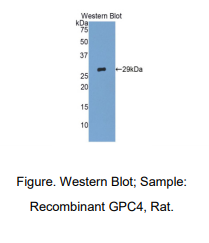 大鼠磷脂酰肌醇蛋白聚糖4(GPC4)多克隆抗体