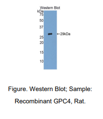 https://msimg.bioon.com/bionline/goods-no-pic.png