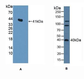 大鼠矢车菊苷α2(CENTa2)多克隆抗体