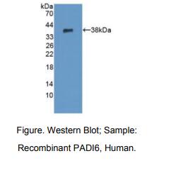 https://msimg.bioon.com/bionline/goods-no-pic.png