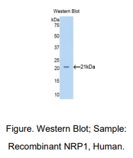 https://msimg.bioon.com/bionline/goods-no-pic.png