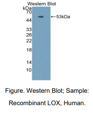 https://msimg.bioon.com/bionline/goods-no-pic.png