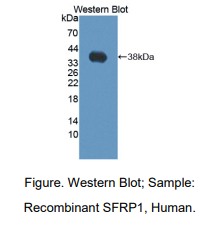 https://msimg.bioon.com/bionline/goods-no-pic.png