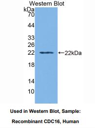 人细胞分裂周期因子16(CDC16)多克隆抗体