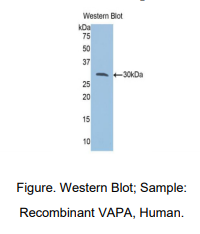 人囊泡关联膜蛋白关联蛋白A(VAPA)多克隆抗体